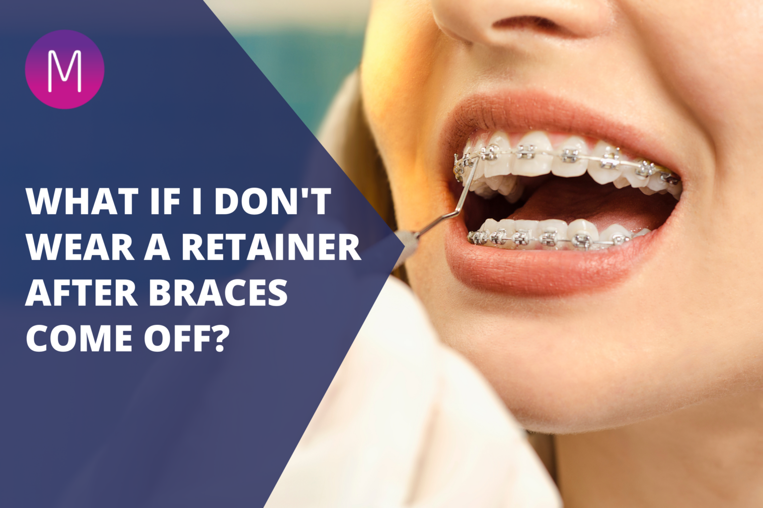If I Wear My Retainer Enough Will It Fit Again What If I Don’t Wear a Retainer After Braces Come Off? - Medland