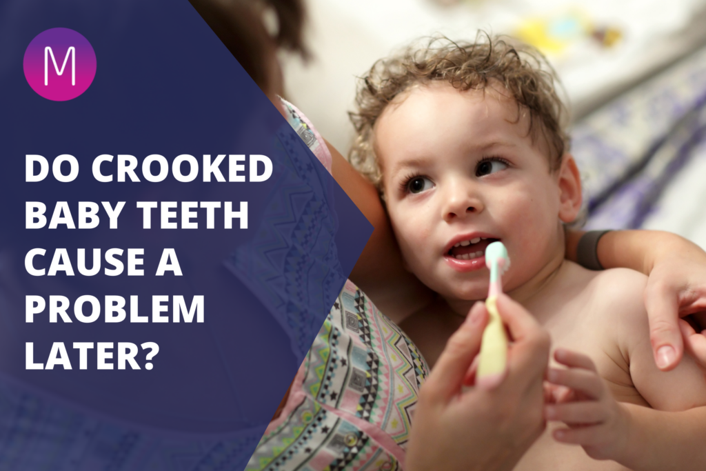 Crooked Baby Teeth Cause a Problem Later in Childhood?