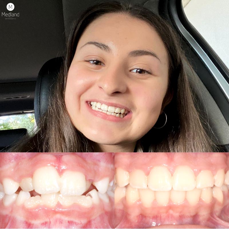 Patient Smiles, Medland Orthodontics Reviews